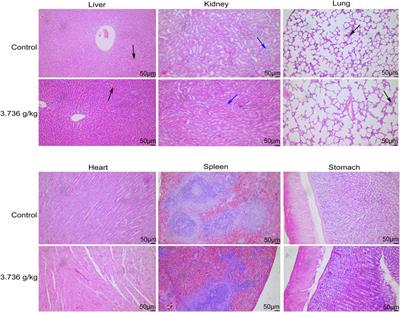 Integration of transcriptomics and metabolomics reveals toxicological mechanisms of ZhuRiHeng drop pill in the 180-day repeated oral toxicity study